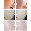 LED Máscara Facial Ligero Facial   Protección de la Piel Facial Cuerpo Terapia para Rejuvenecimiento de Piel Removedor de Acné,